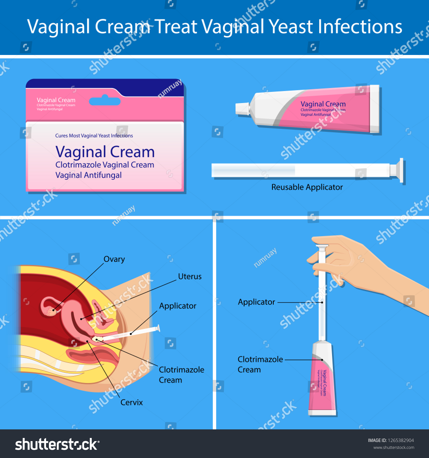Yeast Infection Vagina Yeast Infection Vagina
