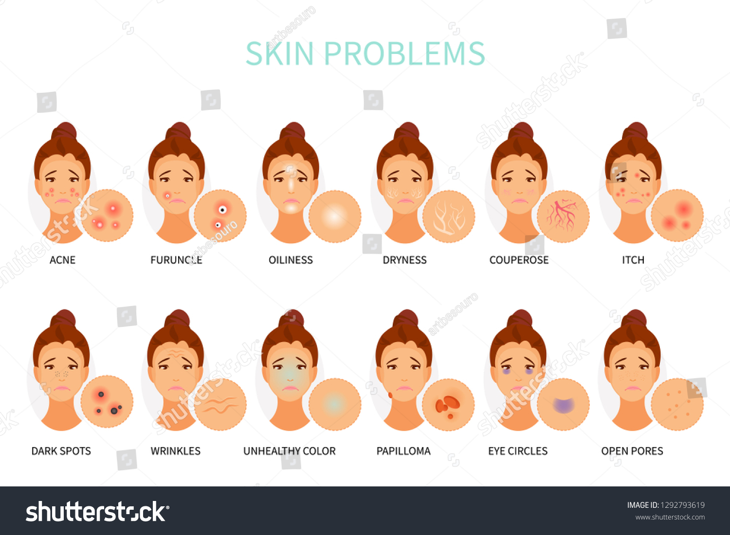 Various Skin Problems Dermatology Cosmetology Vector Stock Vector ...