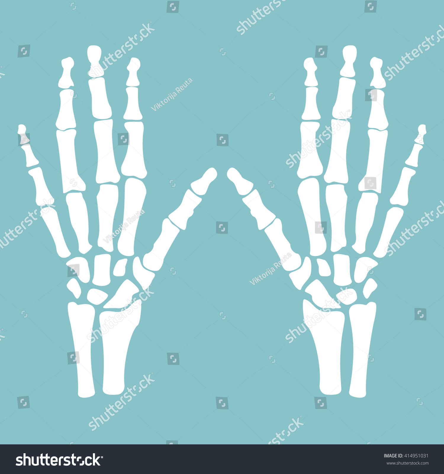 Vector Illustration Hands Bones Orthopedic Human Stock Vector Royalty Free