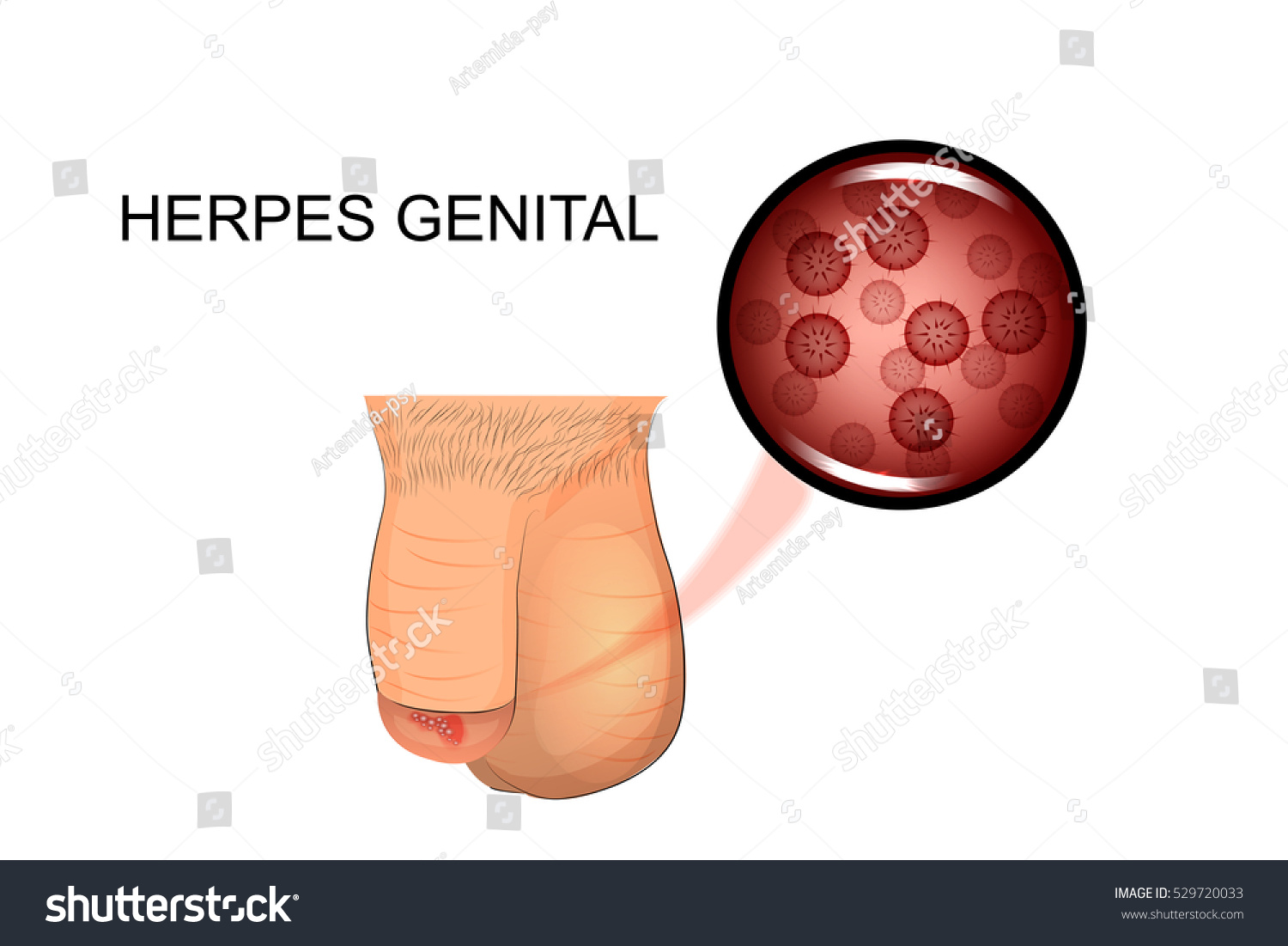 penisul masculin la microscop