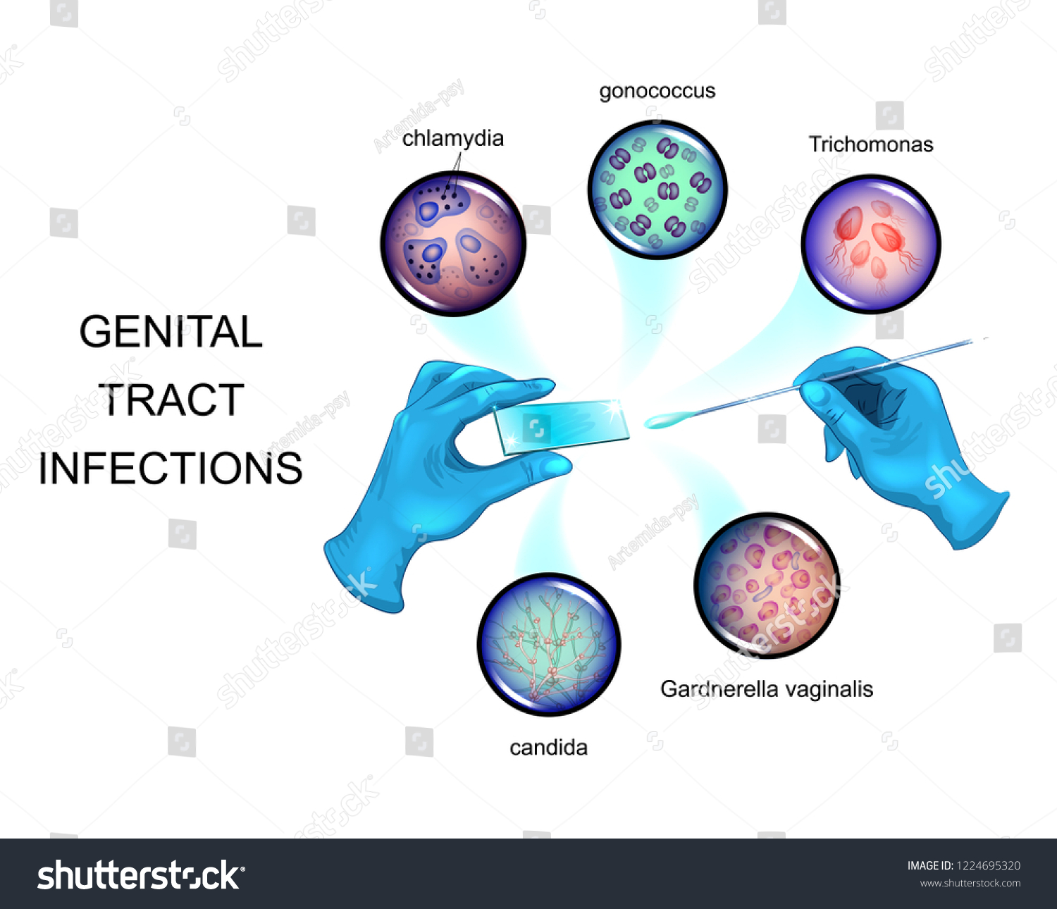 Vector Illustration Pathogens Sexually Transmitted Infections Stock 7212