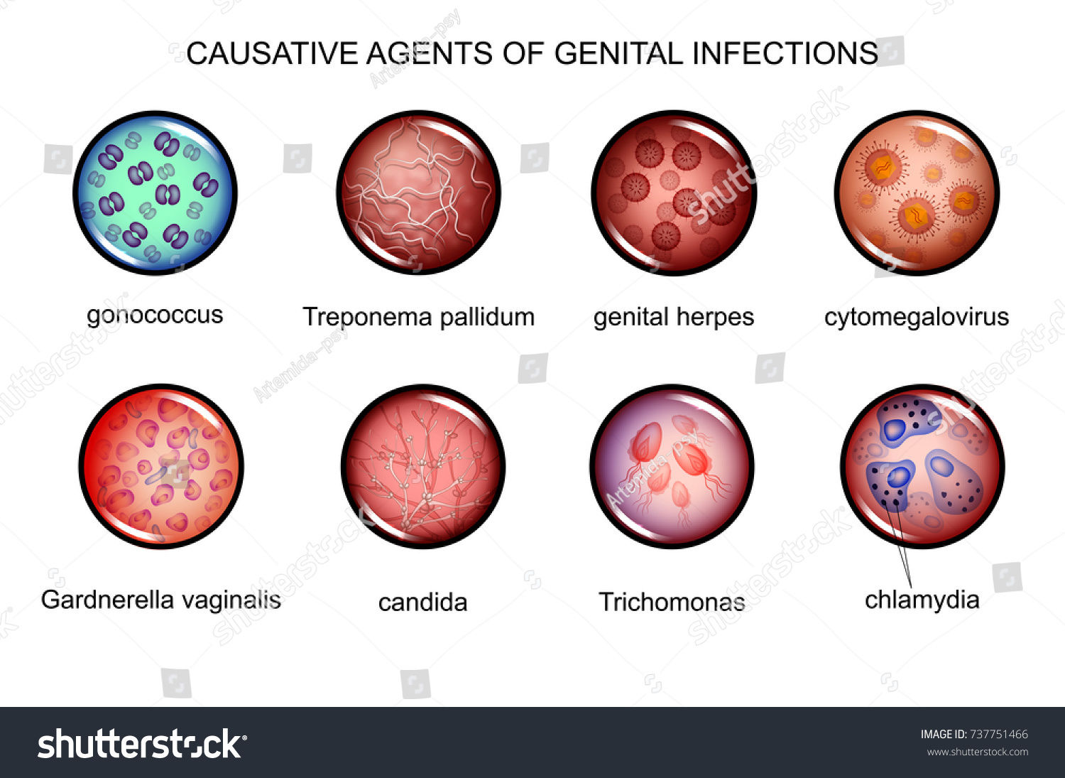 sexually-transmitted-disease-images-stock-photos-vectors