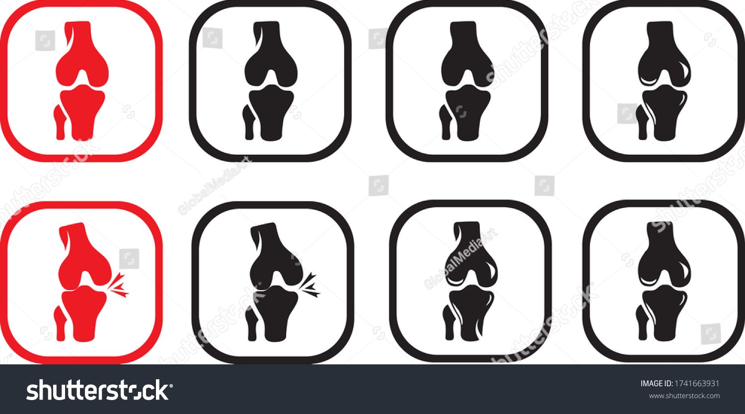 Vector Logo Knee Joints Stock Vector Royalty Free