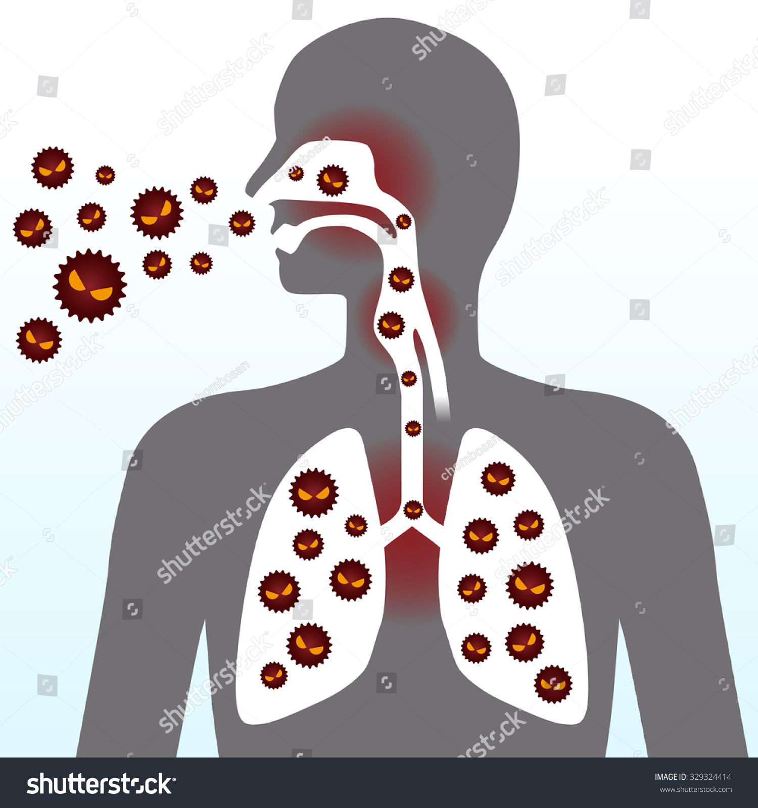 Virus Infection Image Illustration Stock Vector 329324414 - Shutterstock