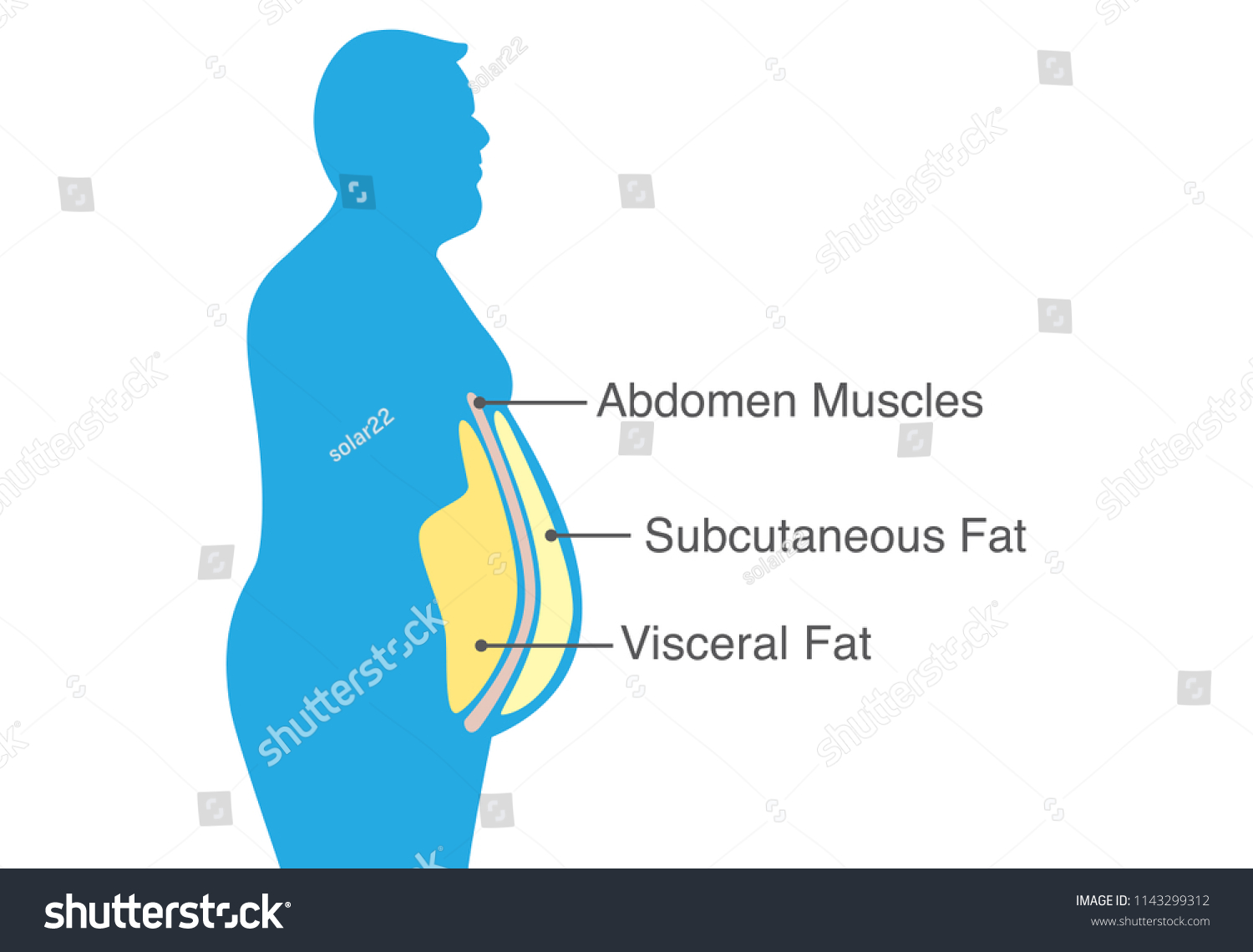 Visceral Fat Subcutaneous Fat That Accumulate Stock Vector (royalty 