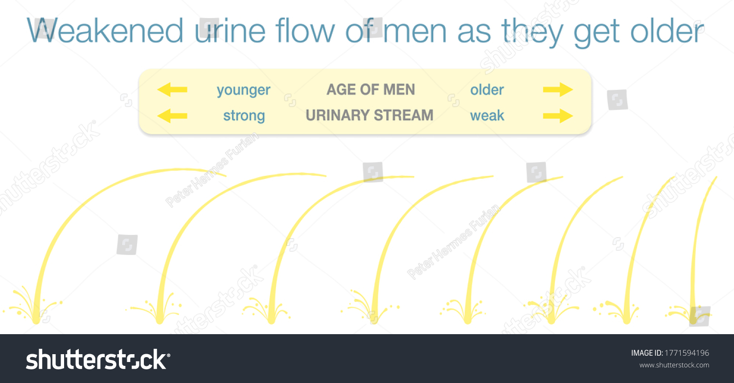 34 Urinary stream Images, Stock Photos & Vectors | Shutterstock