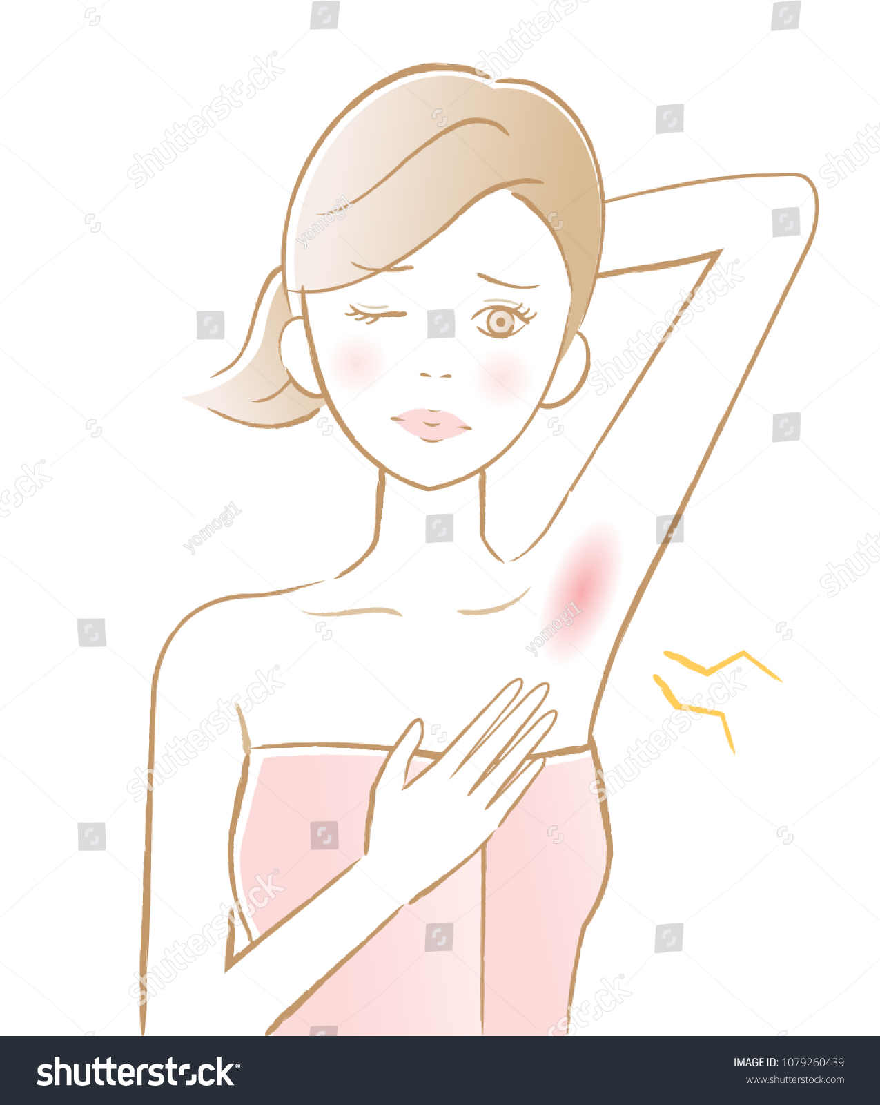 Armpit Hair Removal Underarm Red Rash Stock Vector (Royalty Free ...