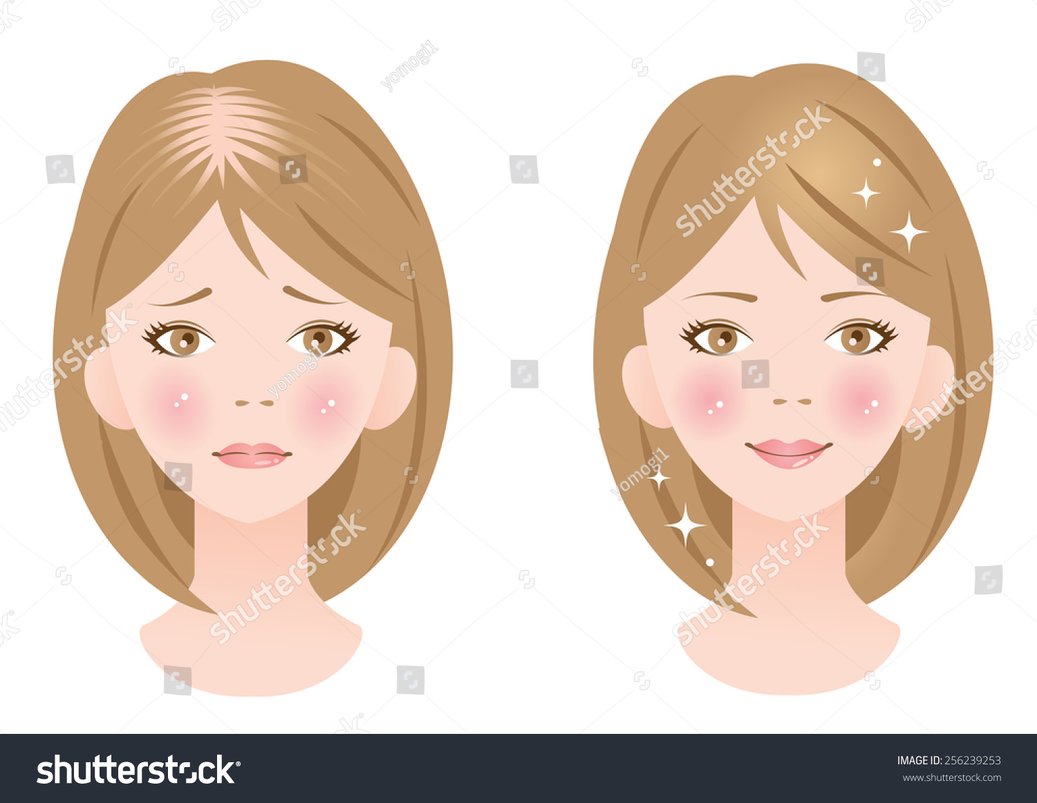 Thinning Hair Before After Stock Vector (Royalty Free) 256239253