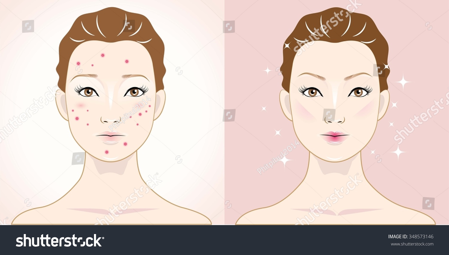 Woman With Acne And Happy One With Healthy Skin. Stock Vector ...