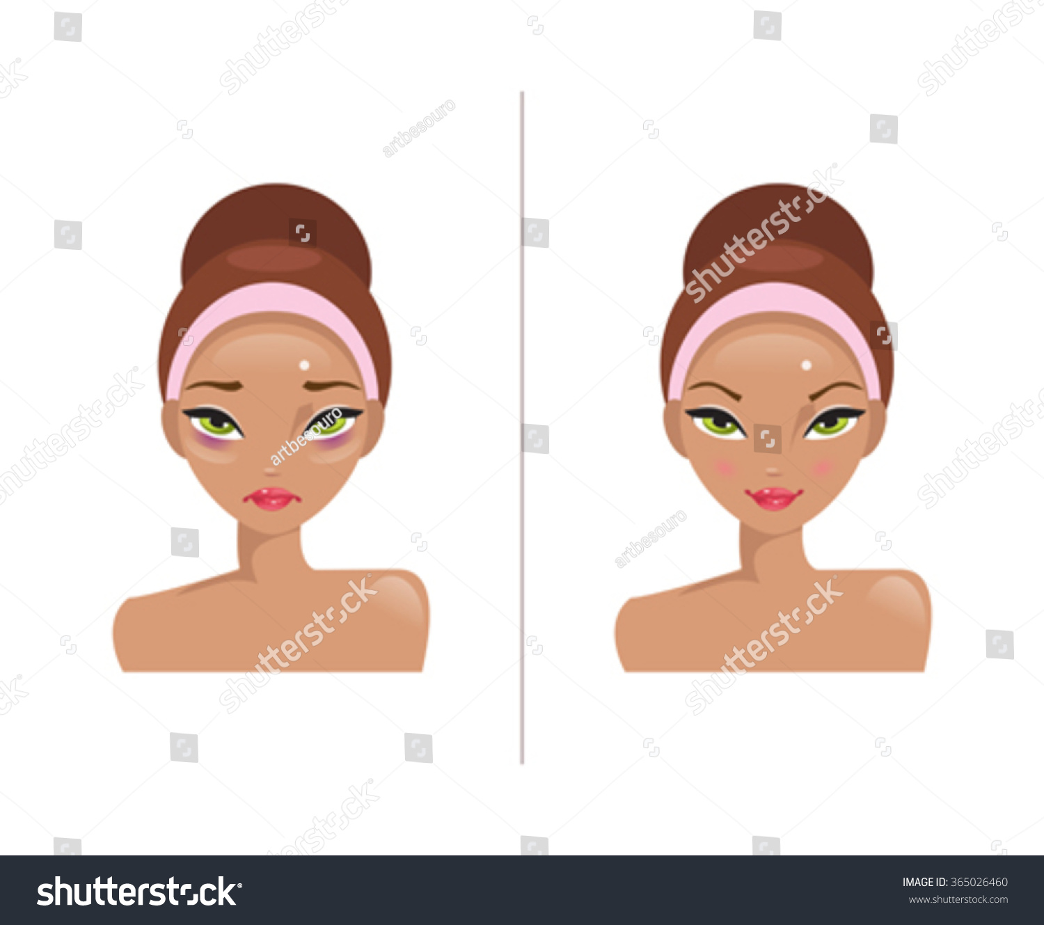Woman Bags Under His Eyes Healthy Stock Vector (Royalty Free) 365026460