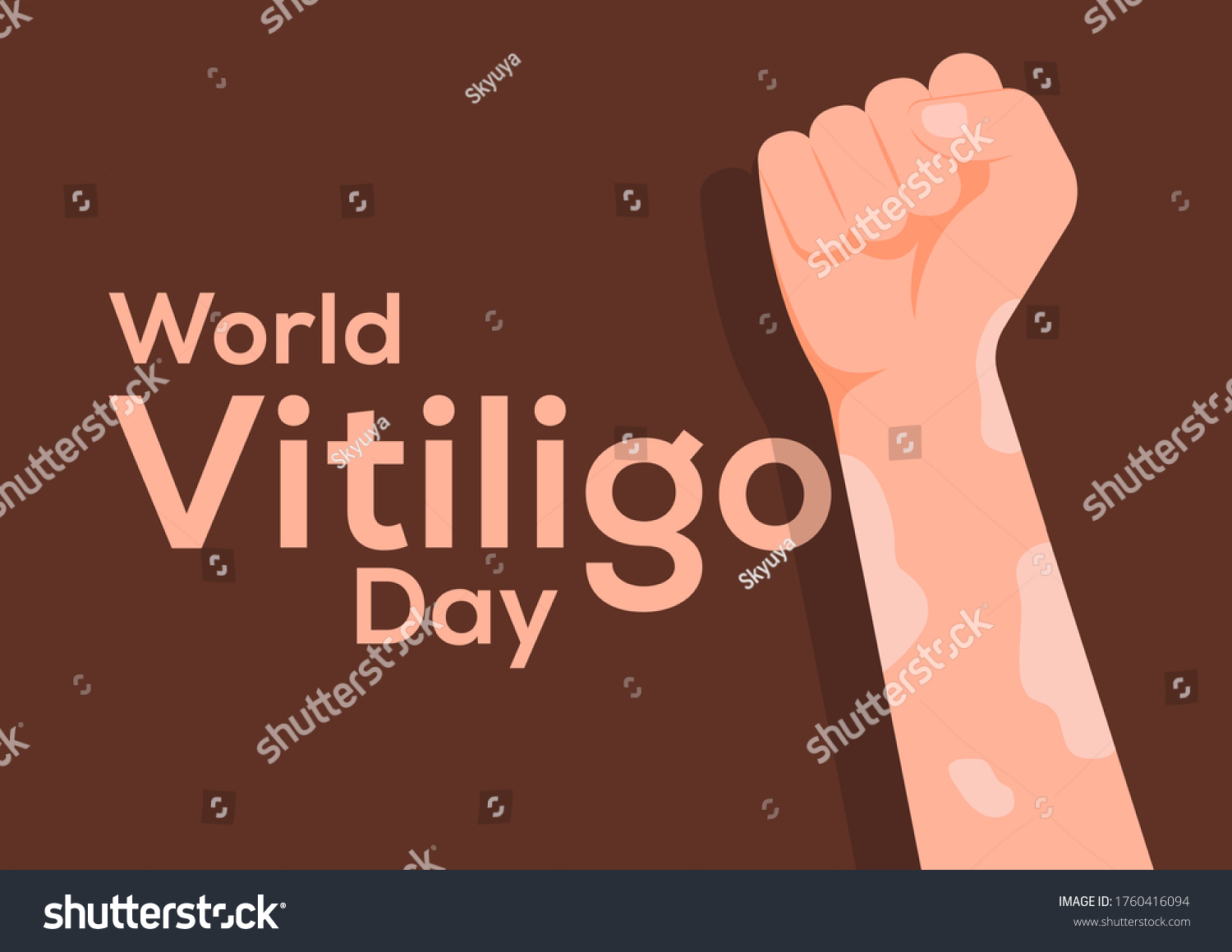 World Vitiligo Day Posterhand Vitiligo เวกเตอร์สต็อก (ปลอดค่าลิขสิทธิ์