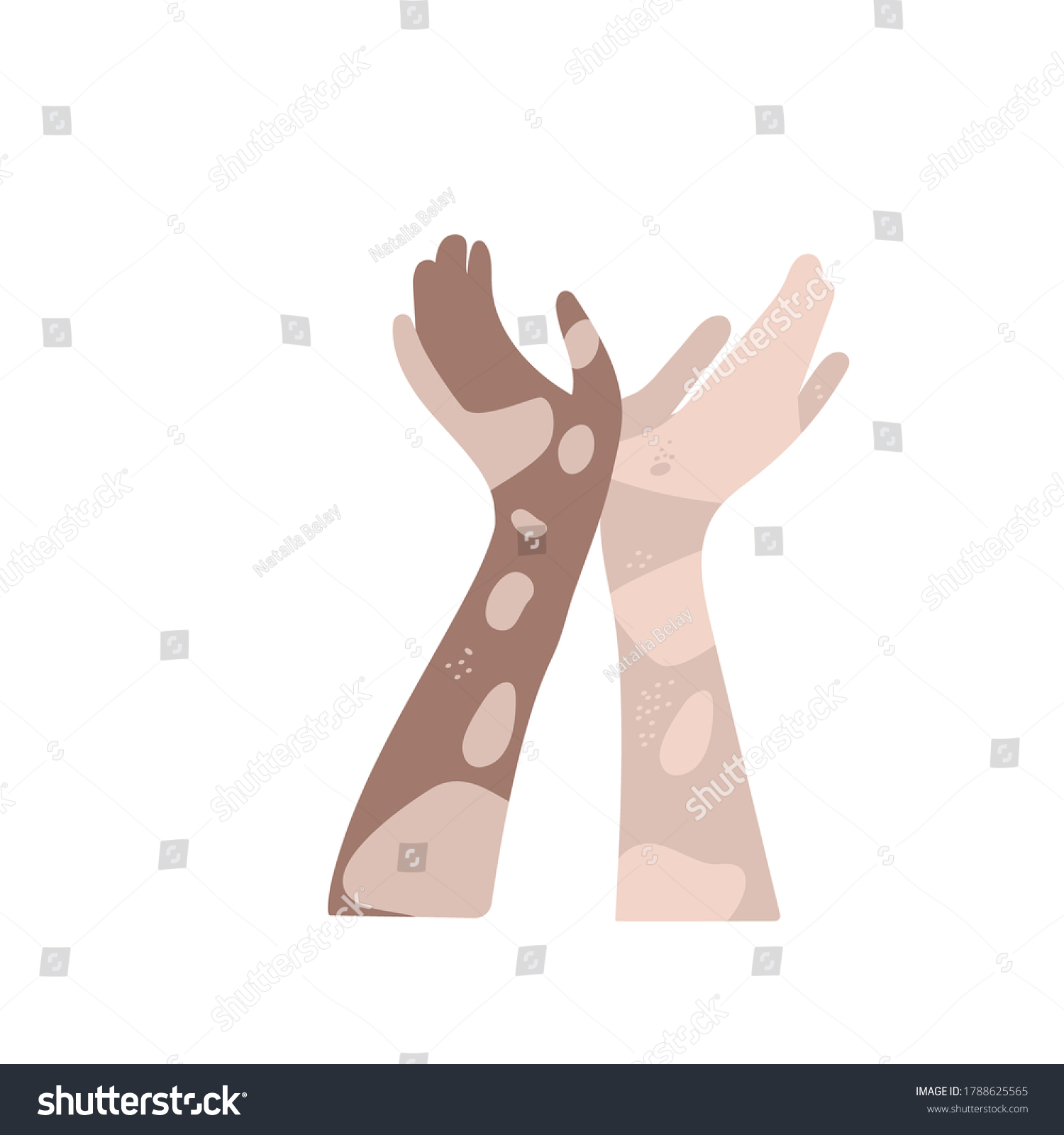 World Vitiligo Day Vector Template Hands Stock Vector (Royalty Free ...