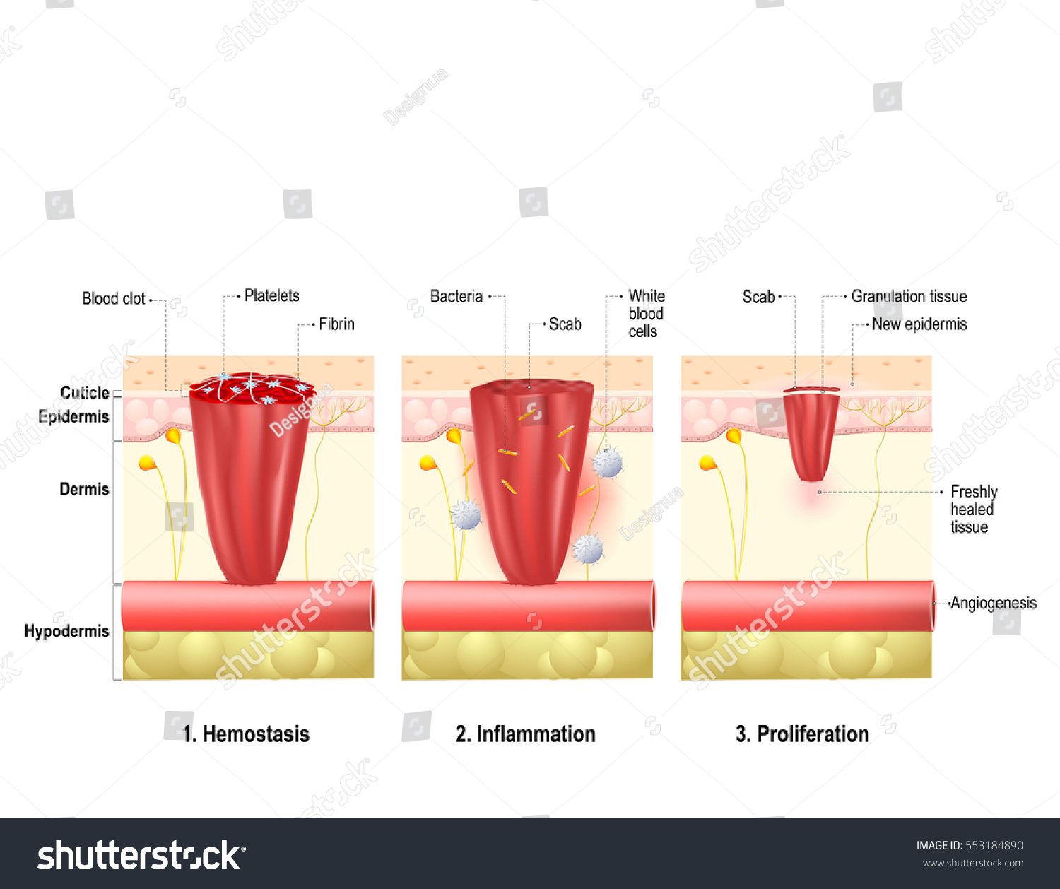 Wound Healing Process Body Tissue Repairs Stock Vector