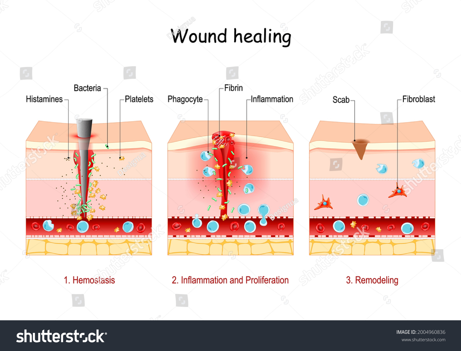 4 Hemophilias bacteria vector Images, Stock Photos & Vectors | Shutterstock