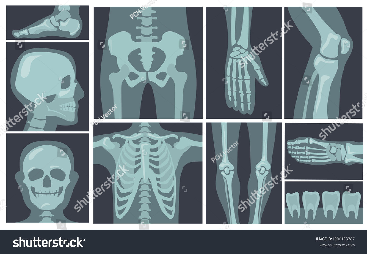 X ray cartoon Images, Stock Photos & Vectors Shutterstock