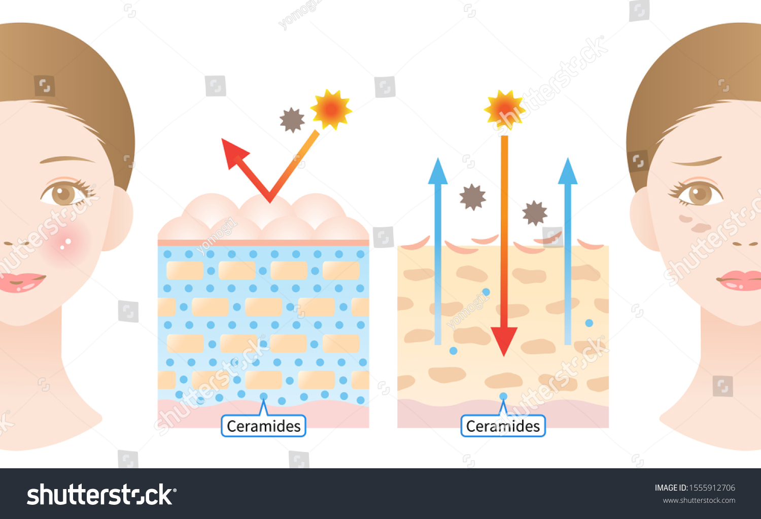 Young Skin Contains Ceramides That Produce Stock Vector (Royalty Free ...