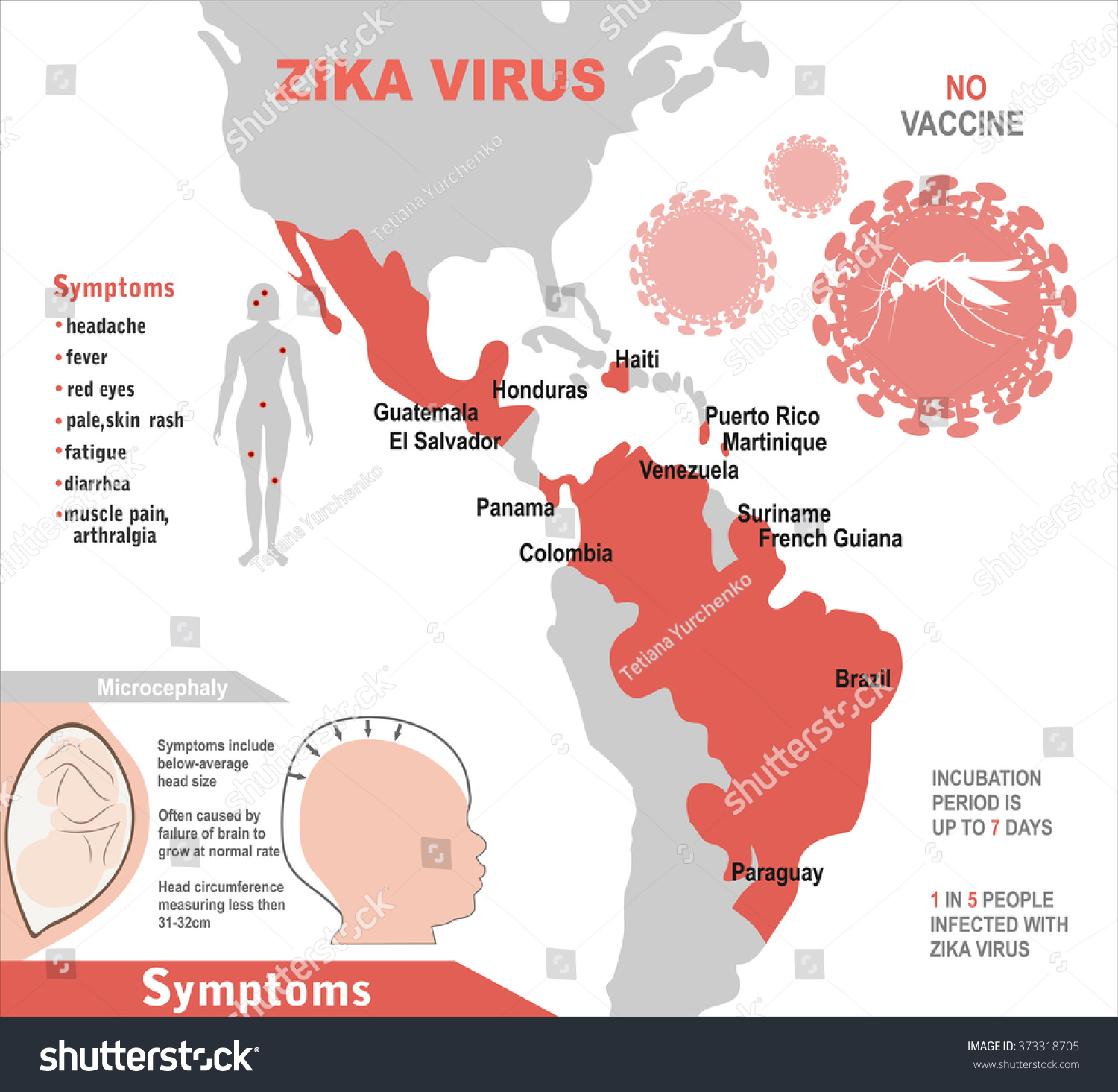 Zika Virus Infographic Elements Prevention Transmission Stock Vector Royalty Free 373318705 8805